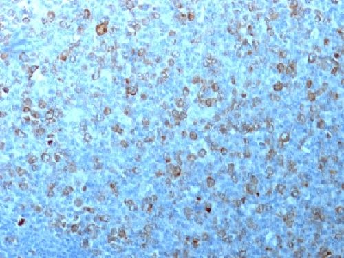 CDK1 Antibody