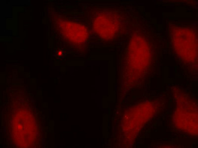 CDC25C Antibody