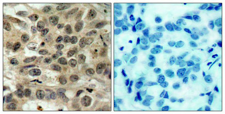 CDC25C Antibody