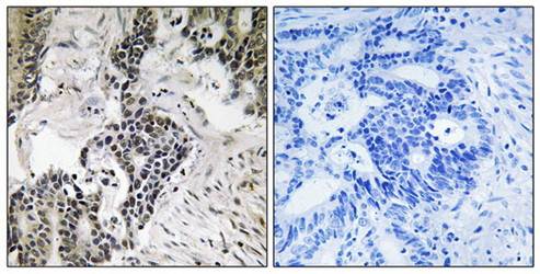 CDC25C (Phospho-Ser198) Antibody