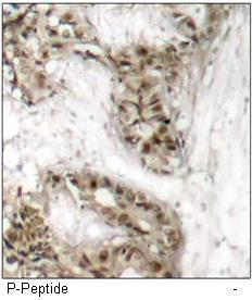 cdc25C (Phospho-Ser216) Antibody