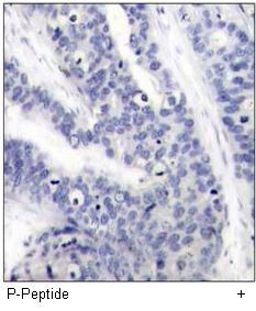 cdc25C (Phospho-Ser216) Antibody