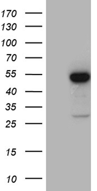 CDC42BPA Antibody