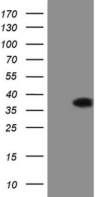 CDC42BPA Antibody