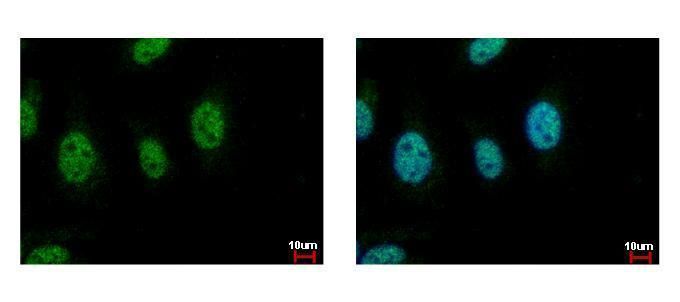 cell division cycle 45 Antibody