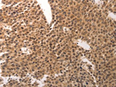 CDC6 Antibody