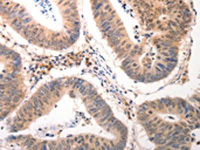 CDC6 Antibody