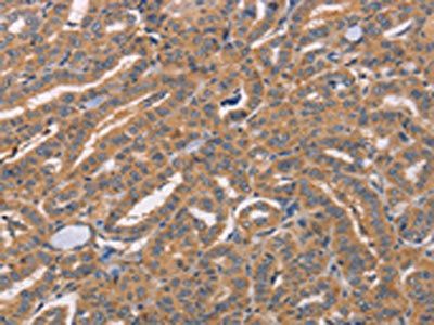 CDCA4 Antibody
