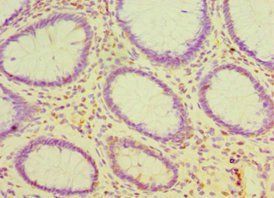 CDH16 Antibody