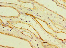 CDH16 Antibody