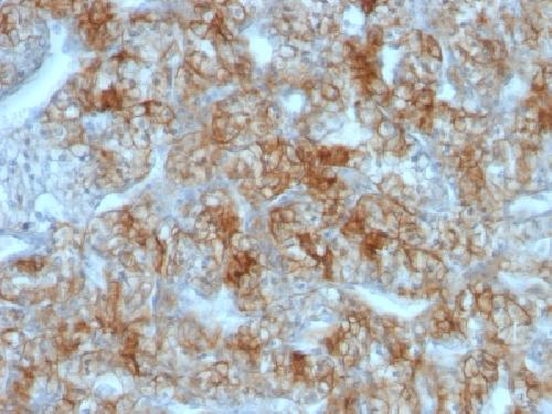 CDH16 Antibody
