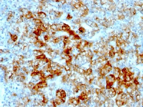 CDH16 Antibody