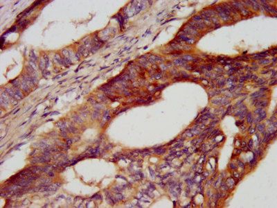 CDH7 Antibody