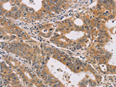 CDK11A/CDK11B Antibody