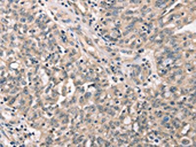 CDK12 Antibody