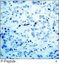 CDK2 (Phospho-Thr160) Antibody