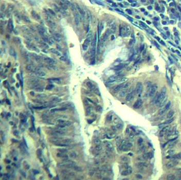 CDK6 (phospho-Tyr24) Antibody