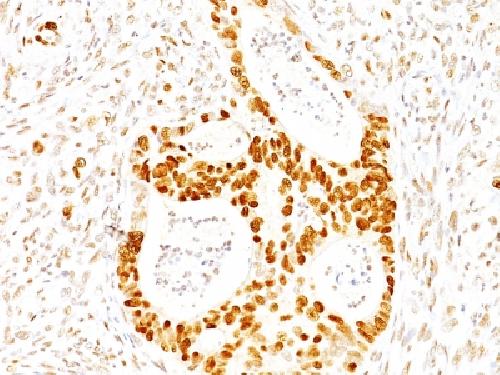 CDKN1B Antibody