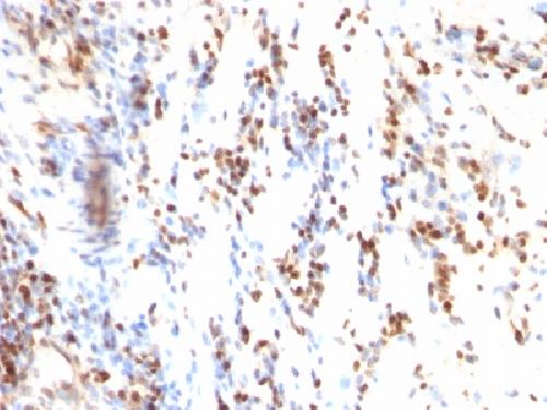 CDKN1B Antibody