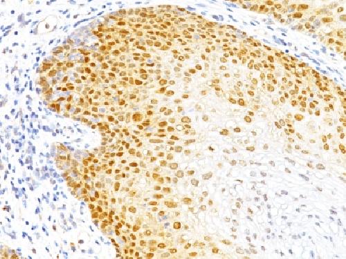 CDKN1B Antibody