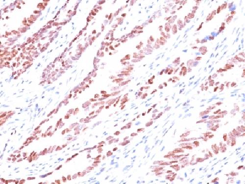 CDKN1C Antibody