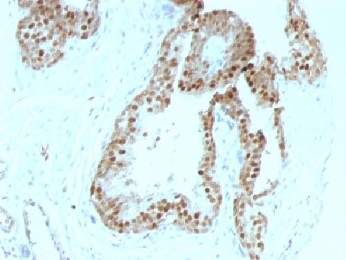 CDKN1C Antibody