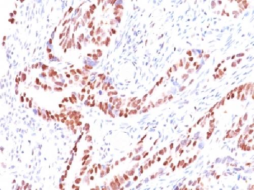 CDKN1C Antibody