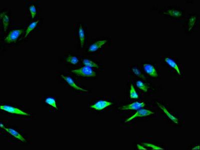 CDKN2B Antibody