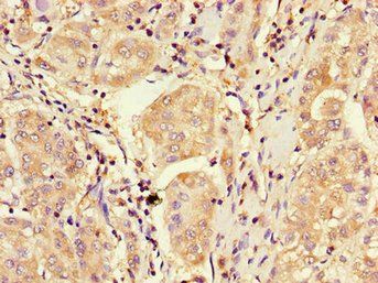 CDKN2B Antibody