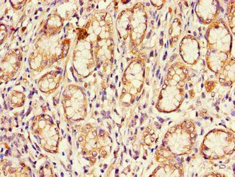 CDKN2B Antibody