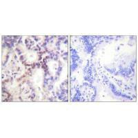 CDKN2B Antibody