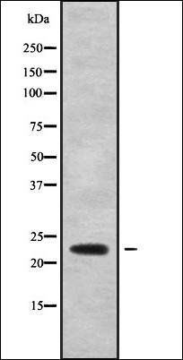 CDO1 Antibody
