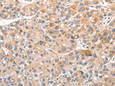 CDR2 Antibody