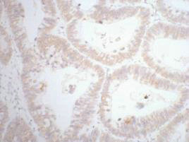 CDX2 Antibody