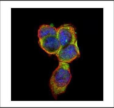 CD66e Rabbit Polyclonal Antibody