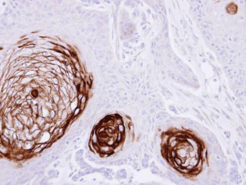 CD66e Rabbit Polyclonal Antibody