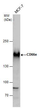 CD66e Rabbit Polyclonal Antibody
