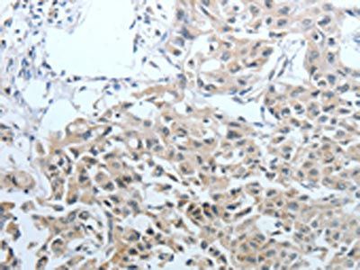 CEACAM1 Antibody