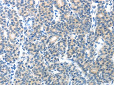 CEACAM1 Antibody