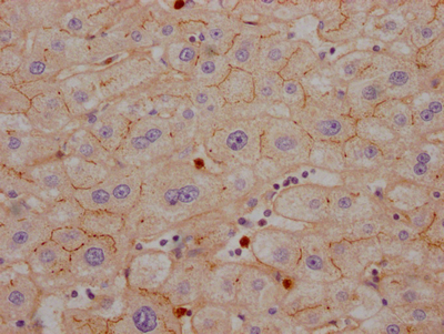 CEACAM1 Antibody