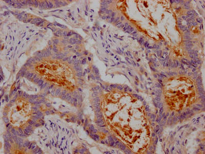 CEACAM1 Antibody