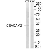 CEACAM21 Antibody