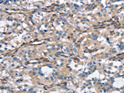 CEACAM3 Antibody