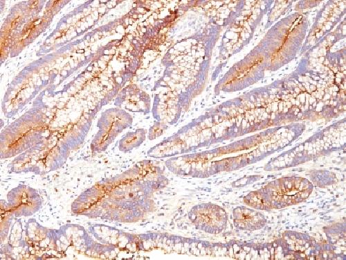 CEACAM5 Antibody