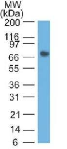 CEACAM5 Antibody