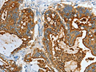 CEACAM5 Antibody