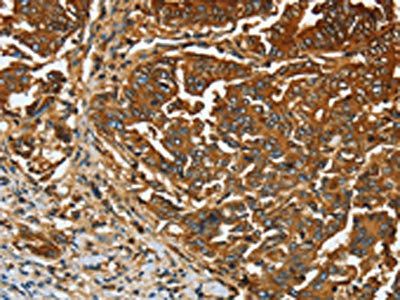 CEACAM5 Antibody