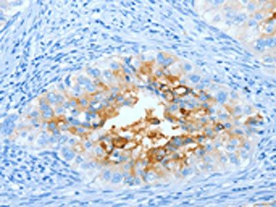 CEACAM5 Antibody