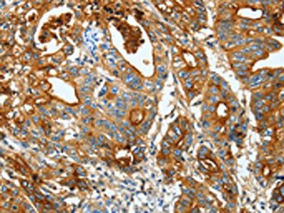 CEACAM5 Antibody