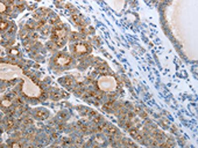 CEACAM5 Antibody